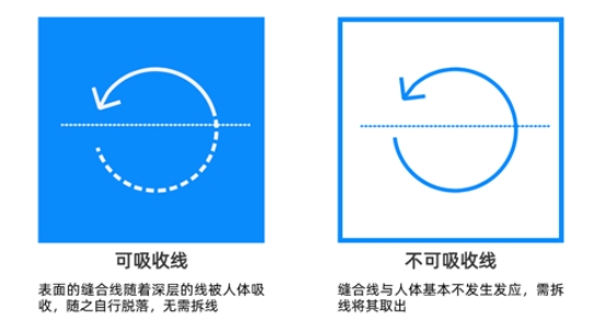 可吸收縫合線與非可吸收縫合線.jpeg